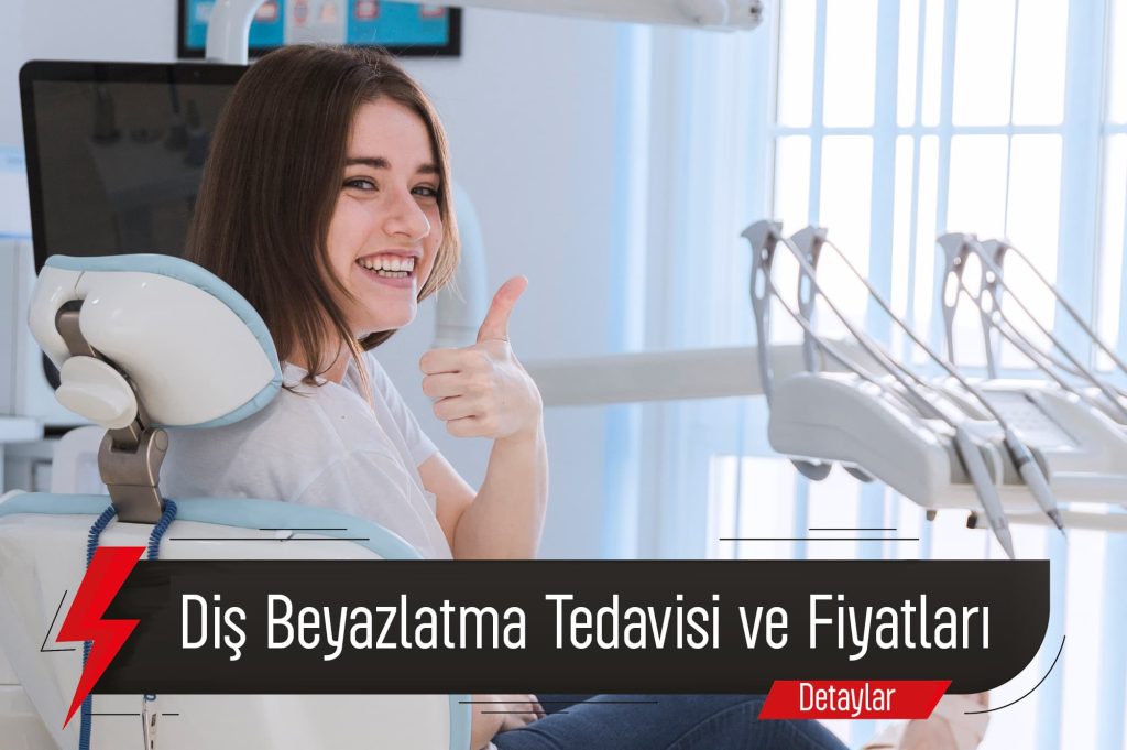 Diş Beyazlatma Tedavisi Ve Fiyatları